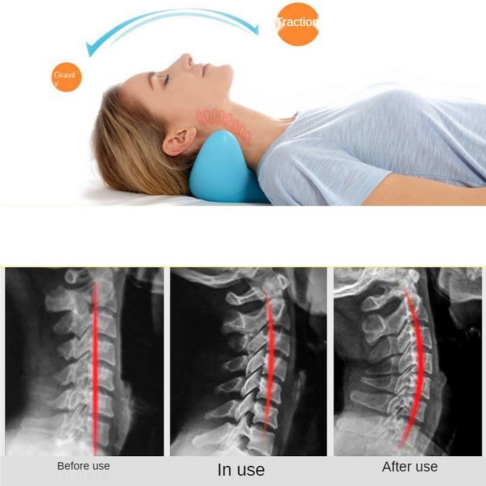 Cuscino per massaggio della colonna vertebrale cervicale Massaggiatore per digitopressione a gravità Cuscino per la colonna vertebrale cervicale Cuscino per massaggio alla spalla del collo Correttore di trazione domestico