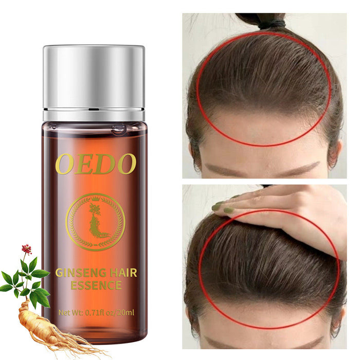 Ätherisches Öl für die Haarpflege von Frauen 20ml Feuchtigkeitsspendend