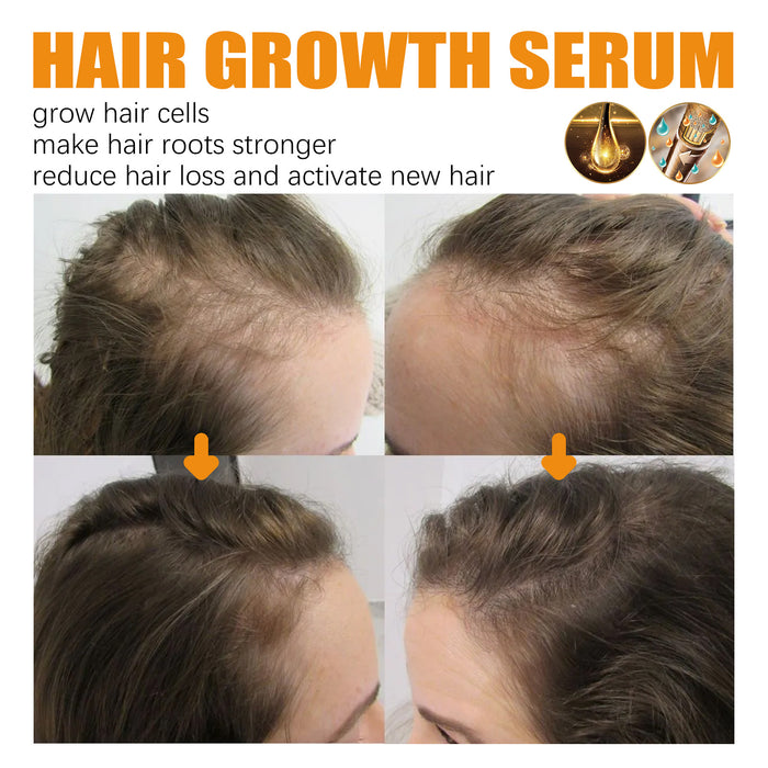 Haarwachstum Reparatur Pflege Ätherisches Öl